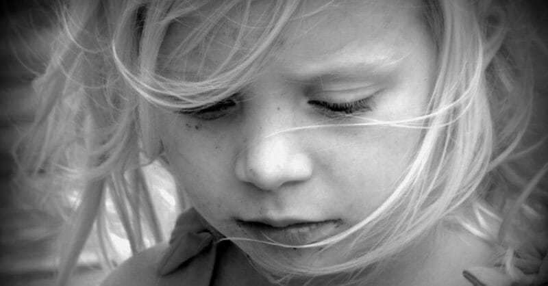 Menina de 10 anos com lupus eritomatoso, uma doença auto-imune. Ela está com o olhar triste olhando para baixo
